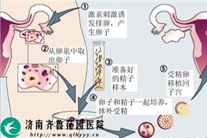 一、试管助孕分析。从这些方面看北京供卵试管婴儿技术的优势