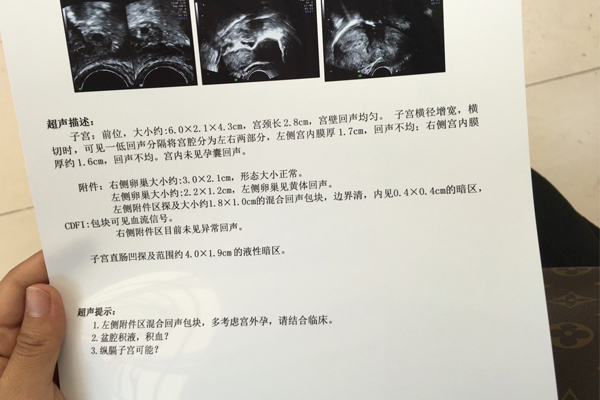 北京省妇幼保健院供卵试管婴儿怎么样