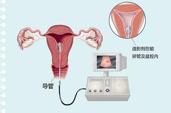 北京市中心医院供卵做试管婴儿流程