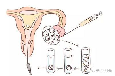 黏液性卵巢囊肿严重吗？女性患者要注意什么？