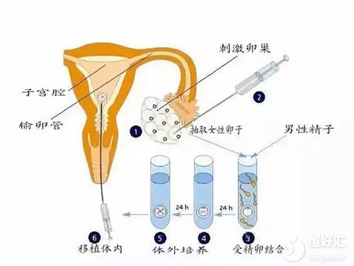 北京胚胎试管代怀协议多少钱啊？