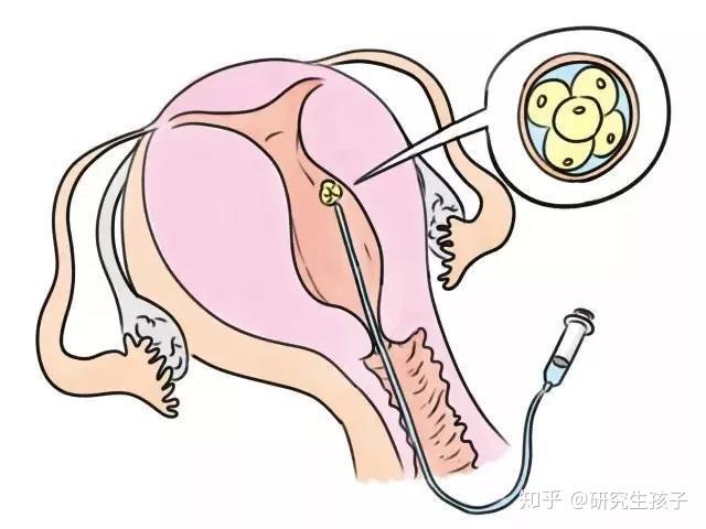 2024北京生殖科最好的医院排行榜,附选性别的代怀是三代吗生龙凤胎流程一览