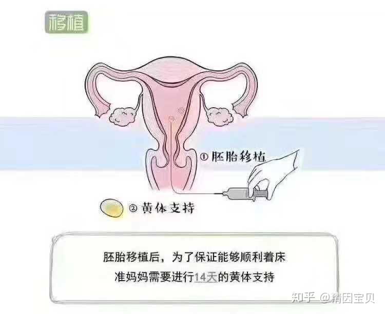 2024北京市代生流程婴儿大概要多少钱