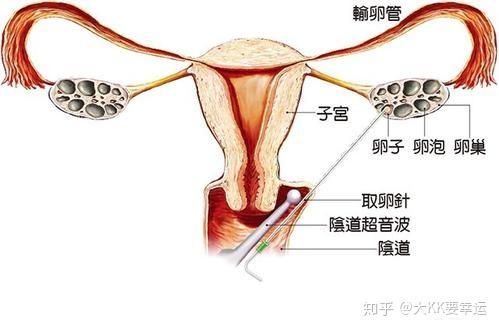 45岁高龄代怀包成功套餐可靠吗生二胎如何提高卵子质量与活力